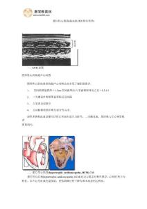 肥厚性心肌病