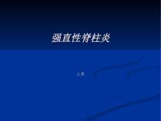 强直性脊柱炎最新