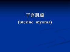 子宫肌瘤10692