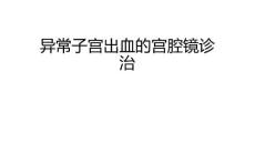 异常子宫出血宫腔镜诊治