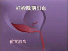 妊娠晚期出血性疾病