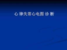 心律失常分类