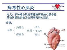 病毒性心肌炎新