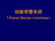 动脉导管未闭.ppt