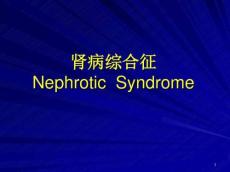 最新肾病综合征肾病综合征诊断标准
