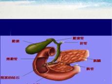 胆囊结石PPT课件
