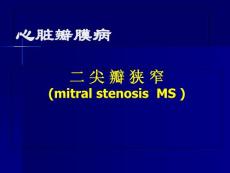 二尖瓣狭窄讲课 课件
