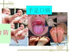 手足口病