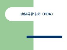 动脉导管未闭