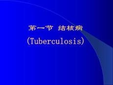 结核病解读