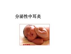 分泌性中耳炎诊治