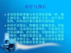 骨软骨瘤分析课件