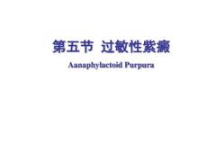 过敏性紫癜