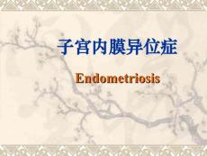 子宫内膜异位症【-】