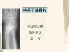 桡骨下端骨折