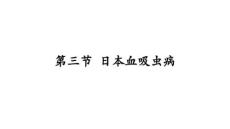 日本血吸虫病