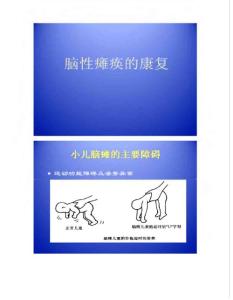 小儿脑瘫康复