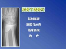 桡骨下端骨折