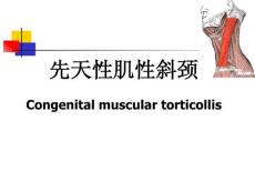 小儿外科学：先天性肌性斜颈