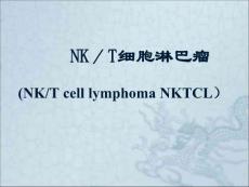 NK／T细胞淋巴瘤课件