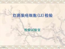红斑狼疮检查专家讲座