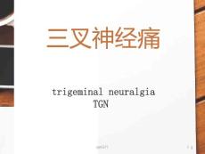 三叉神经痛--课件