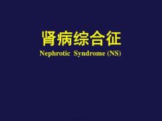 肾病综合征最新