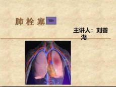 肺栓塞_2