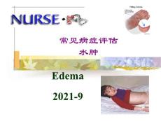 水肿课件