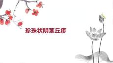 珍珠状阴茎丘疹