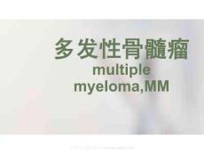 多发性骨髓瘤38151