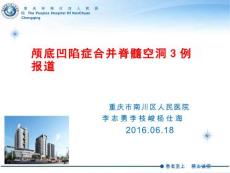 颅底凹陷症影像学诊断课件