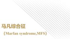 马凡综合征介绍