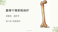 《股骨干骨折骨折》ppt课件