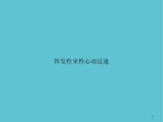 阵发性室性心动过速课件