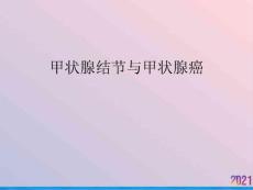 甲状腺结节与甲状腺癌课件