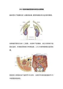 2023医源性输尿管损伤诊断及处理策略