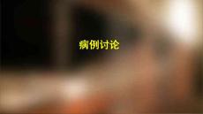 尿崩症病例讨论课件
