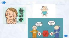 荨麻疹_2