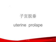 子宫脱垂--ppt课件