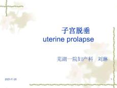 子宫脱垂课件