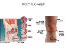 膝关节常见的损伤