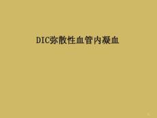 DIC弥散性血管内凝血课件