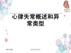 心律失常概述和异常类型ECG心律失常课件