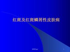 红斑及红斑鳞性皮肤病课件