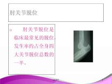 肘关节脱位--课件