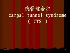 讲课-腕管综合征-课件