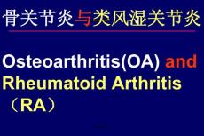 骨关节炎与类风湿关节炎-课件