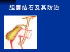 胆囊结石
