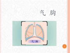 气胸血气胸脓胸护理常规讲课课件